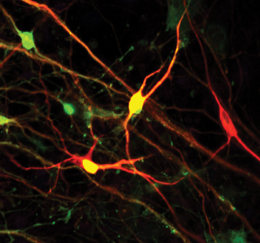 iN cell – The Synapse Symposium
